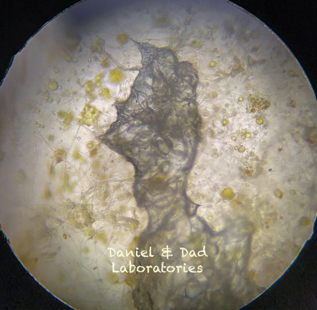 Mold - a microscopic world - [13]