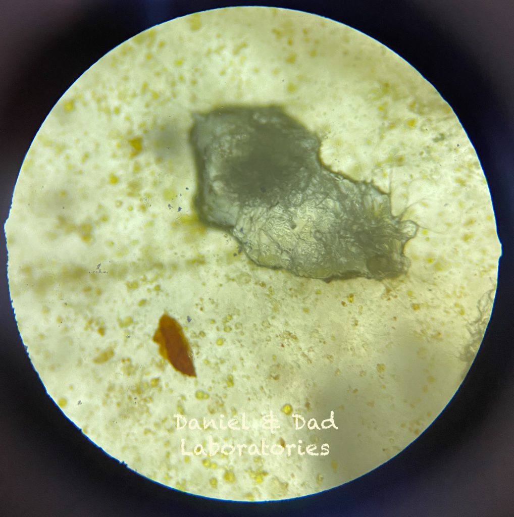 Mold - a microscopic world - [18]