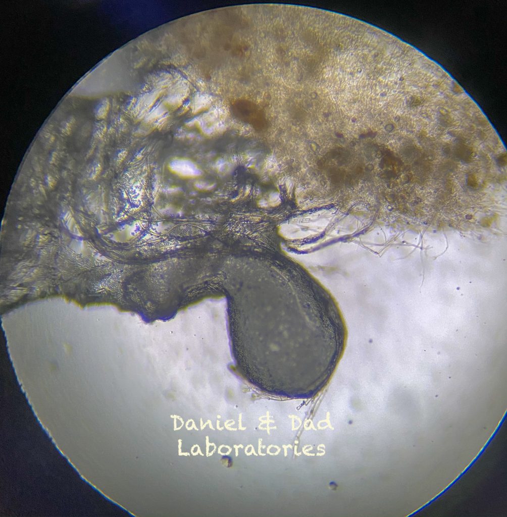 Mold - a microscopic world - [21]